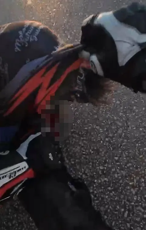  Motosikletiyle bariyere çarpmıştı, hayata 25 gün tutunabildi