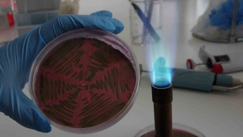 Çiğ Sütteki Gizli Tehlike: Gıdayla Bulaşan İdrar Yolu Enfeksiyonları